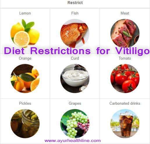 vitiligo_diet_restriction